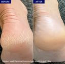 Dermive Urea Moisturizer