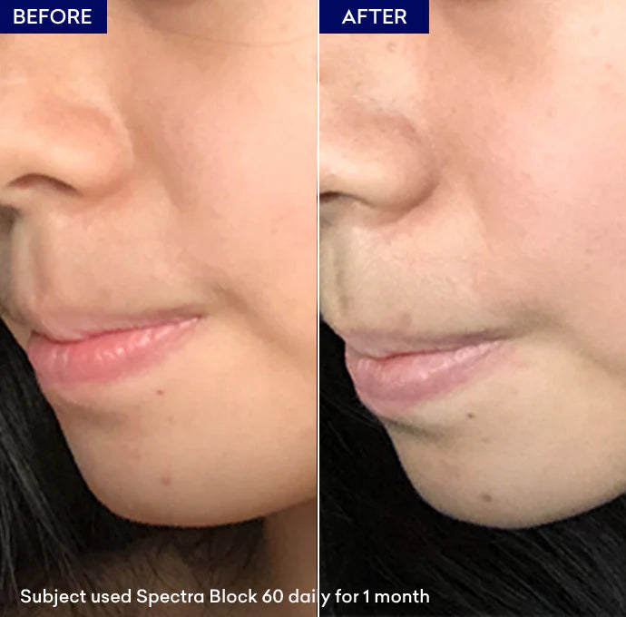 Spectra Block SPF60