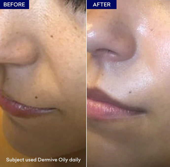 Dermive Oily Moisturizer