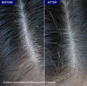 Sebornil Shampoo