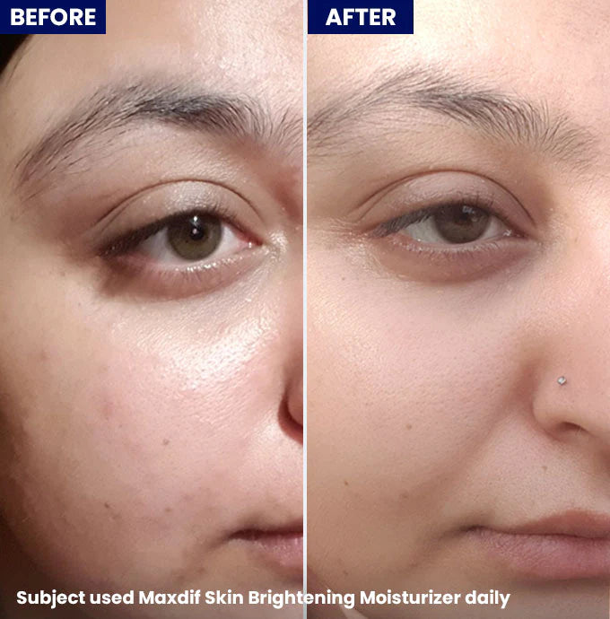 Maxdif Brightening Moisturizer