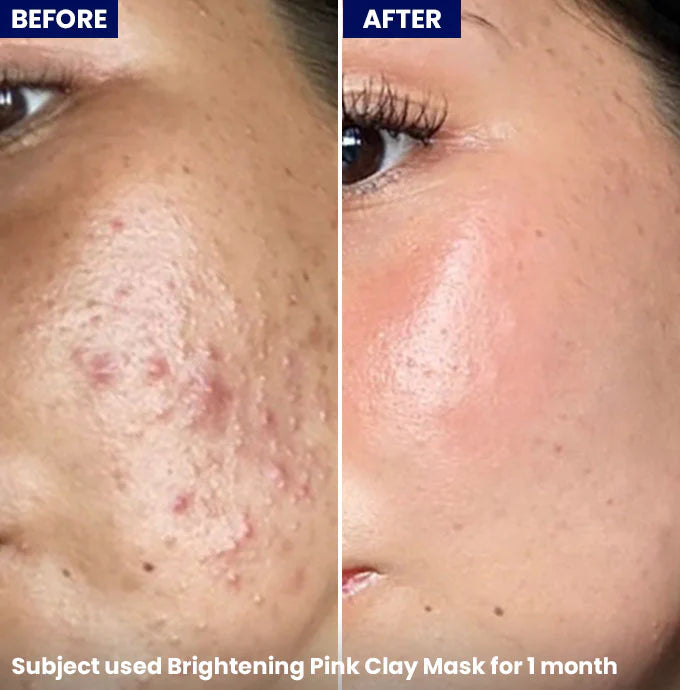Brightening Pink Clay Mask