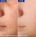 NiaRonic Serum (Pore Minimizing)