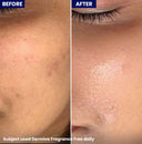 Dermive Oil-Free Fragrance Free Moisturizer
