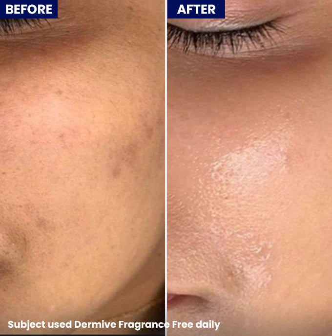 Dermive Oil-Free Fragrance Free Moisturizer