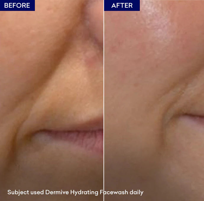 Dermive Moisturizing Face Wash